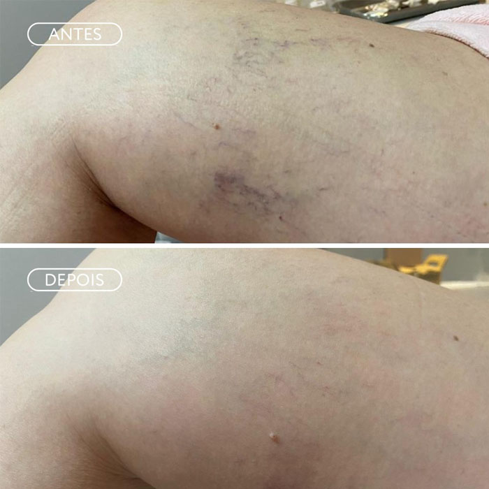 Resultado Skinbooster - Luminosidade